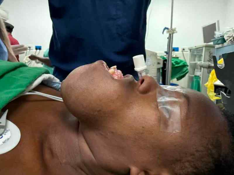 Giving Hope Through Jaw Reconstruction: Treating Ameloblastoma in&nbsp;Kenya