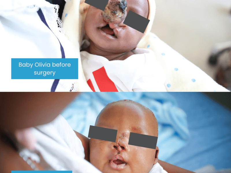Baby Olivia’s Story